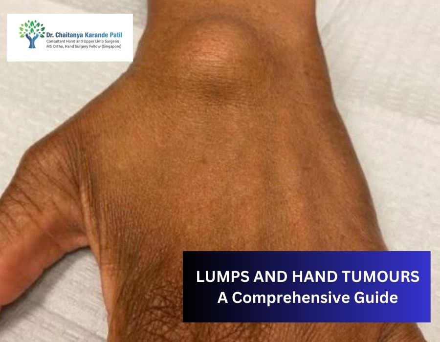 LUMPS AND HAND TUMOURS: A Comprehensive Guide | Dr. Chaitanya Karande