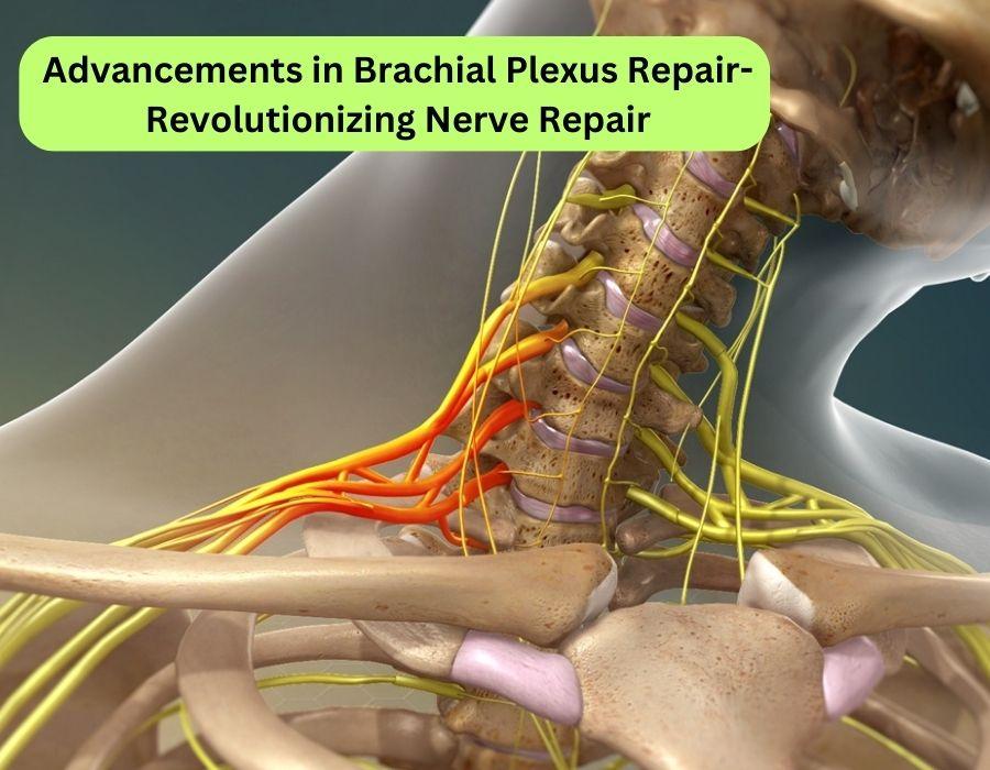 Brachial Plexus Treatment in Kothrud | Dr. Chaitanya Karande