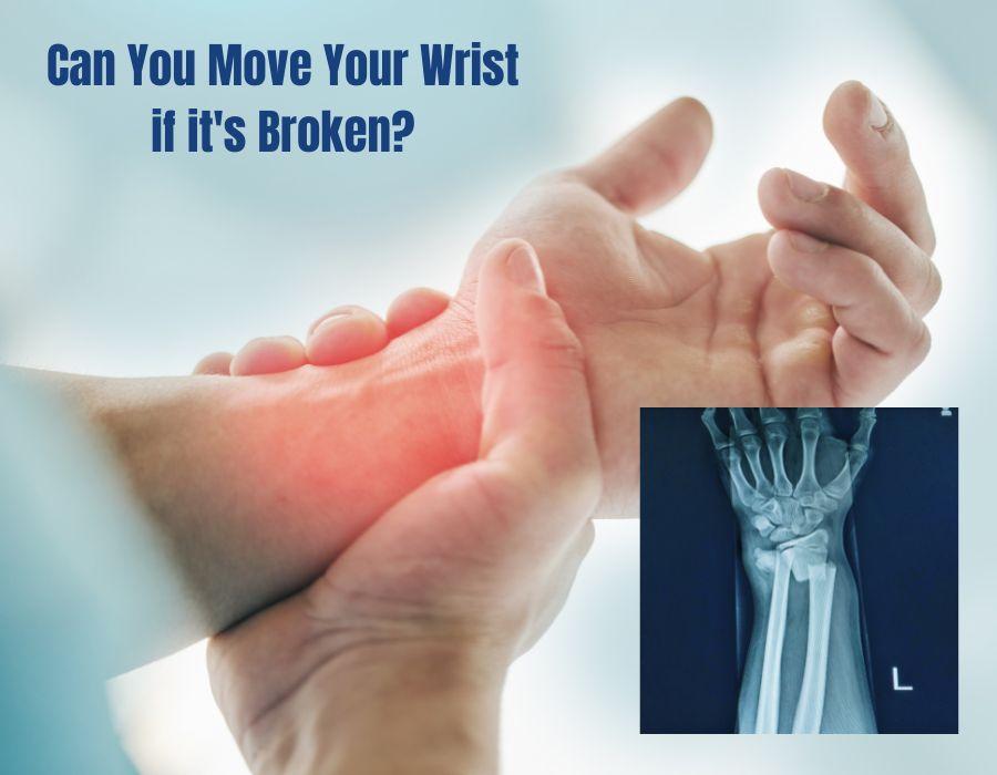 Can You Move Your Wrist if it's Broken? | Dr. Chaitanya Karande