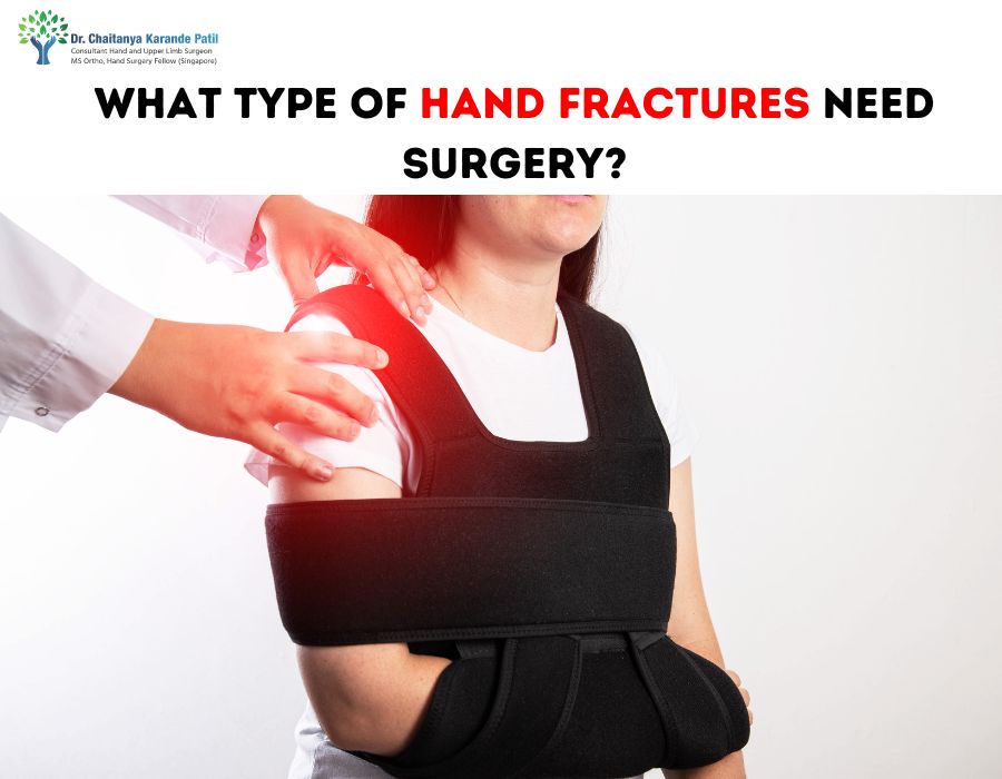 What Types of Hand Fractures Need Surgery?