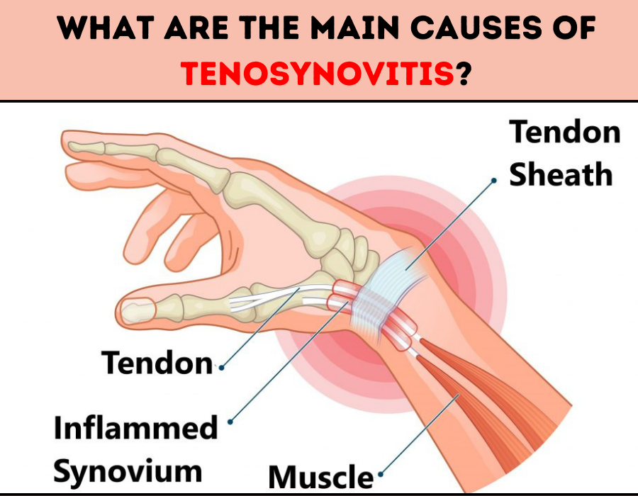 What Are The Main Causes Of Tenosynovitis