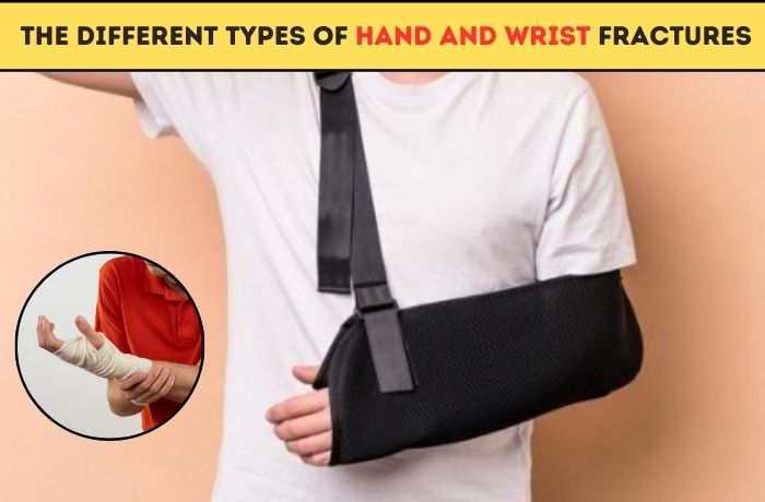 Hand Surgeon in Pune | Wrist fracture surgeons in Pune |the Different Types of Hand and Wrist Fractures