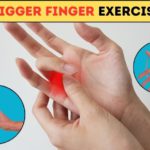Hand surgeon in Pune | Trigger finger surgery in Pune | hand surgery clinics in Pune