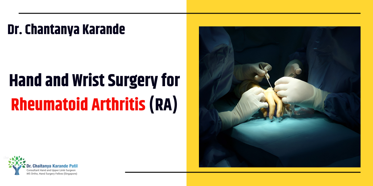 Hand and Wrist Surgery for Rheumatoid Arthritis (RA)